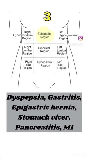 Abdominal Pain Explained | What is Referred Pain? Causes You Must Know!
