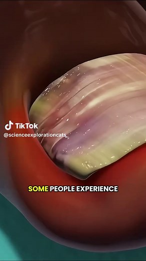 Ingrown Toenail Removal: A Step-by-Step Procedure