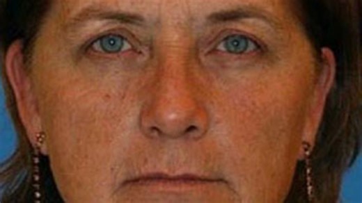 Identical twins shared major difference after one smoked and the other didn’t