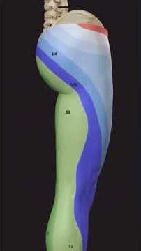 Lumbar Nerve Root Compression: How to Treat for Pain Relief and Recovery?