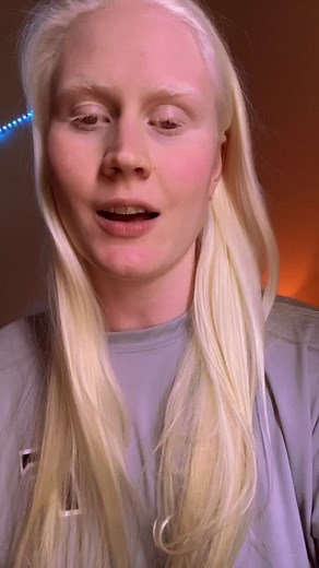 Unveiling the Mysteries of Albino Eyes and Light