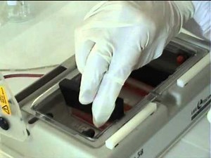 Electrophorèse d'ADN