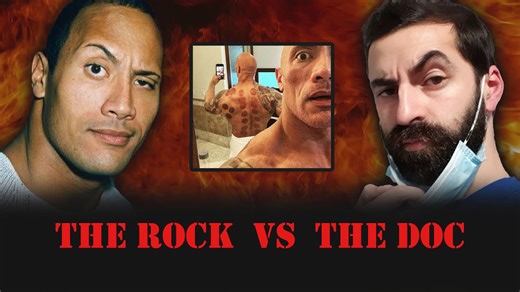 Is Cupping Legit or Just Hype? | The Science Explained