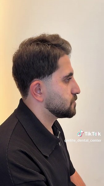 فيديوهات أنشأها سەنتەرێElite یێ ددانا🦷 (@elite_dental_center) باستخدام suono originale - -text._.song-