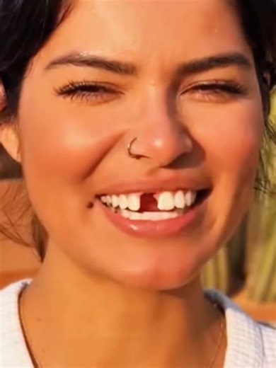 Achieve Your Best Smile with Moldable False Teeth