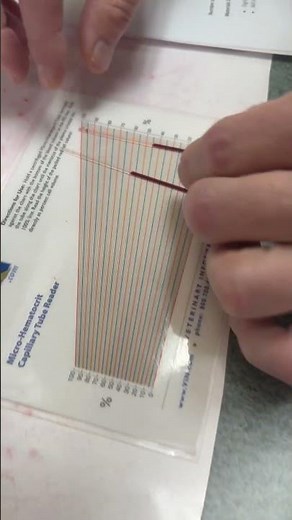 Packed Cell Volume - Micro Hematocrit Capillary Tube Reader