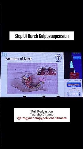 Burch Colposuspension: Simple Steps for Bladder Support