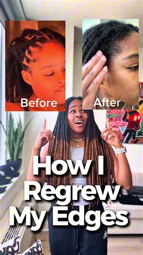 Edges thinning? Hairline Receding? You’re not alone fam we all done been there. But you can reverse this, here’s how I did it.