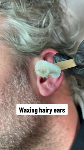 Satisfying Ear Wax Removal Techniques