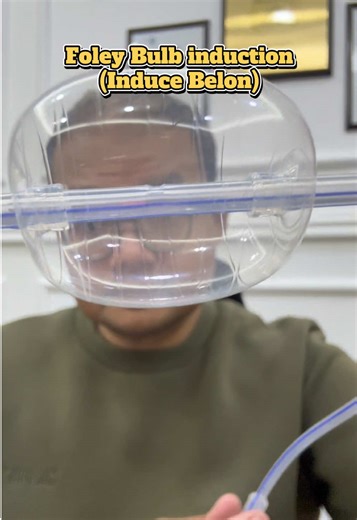 Induksi Persalinan Menggunakan Foley Bulb dan CRB