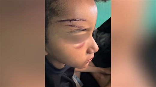 9-year-old boy randomly punched in Bronx park speaks out, teenage suspect arrested