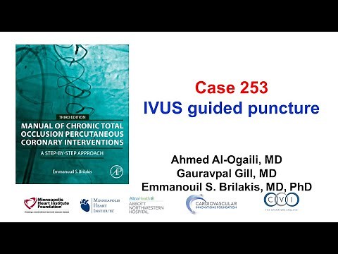 Case 253: Manual of CTO PCI - IVUS guided puncture