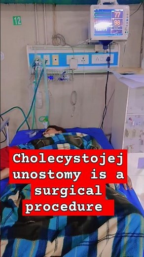 Cholecystojejunostomy: The Surgery That Bypasses Your Bile