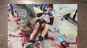 Photos show horror of Boston bombings