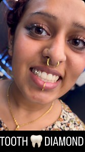 Ithu nalla irukee🤩🤪 | Tooth diamond | Tooth gem 💎 | piercing video | Tantra tattoo #tantratattoo #tattoo #tattooart #instagood #instadaily #instagram #trending #tantra #ink #inkedmag #piercing #tooth #gem #diamond | Tantra tattoos