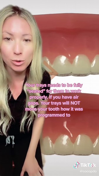 Improve Invisalign Results with Chewies | Orthodontist Tips