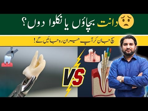 Root Canal vs Tooth Extraction | Which Is Better for Your Tooth? | Dr. Abid Naeem
