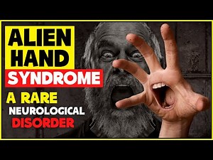 Alien Hand Syndrome: What is? Symptoms, Causes and Treatment | Weirdest and Rarest Diseases