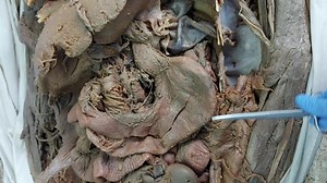 Anatomía del esófago y el cardias en el cuerpo humano