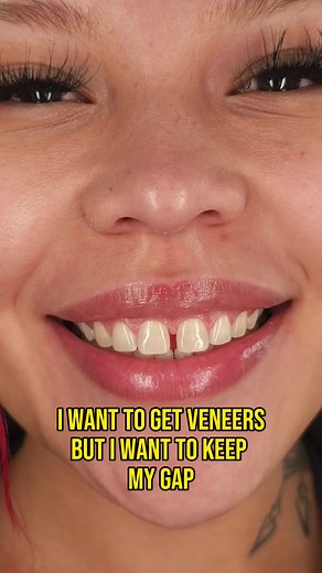 Closing the Gap with Porcelain Veneers: A Life-Changing Smile Transformation