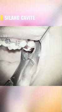 upper molar extraction