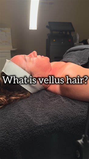 𝑨𝒔𝒉𝒍𝒆𝒚 𝑳𝒚𝒏𝒏 𝑬𝒔𝒕𝒉𝒆𝒕𝒊𝒄𝒔| Acne Expert on Instagram: "✨ Did you know we all have two main types of hair on our face and body? Meet vellus hair (a.k.a. “peach fuzz”). Vellus hair is the soft, fine hair that covers most of your face and body. Unlike terminal hair (think scalp, brows, lashes), vellus hairs are usually lighter and shorter — but they serve an important role! 💡 Why it matters: • Provides a layer of protection for your skin. • Helps regulate temperature and sweat. • Act