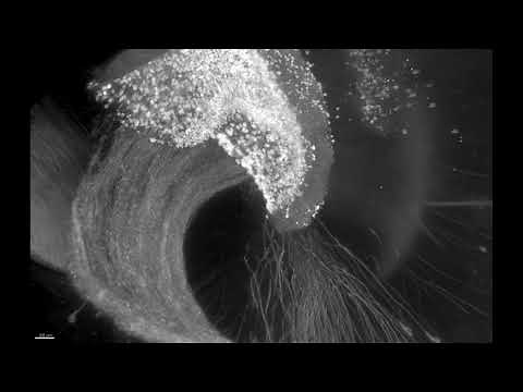 The beauty of the hippocampus