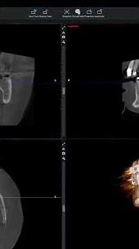 Exporting CBCT Volumes to DICOM Using Planmeca Romexis Short