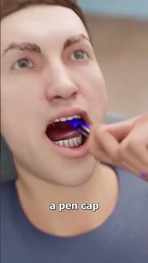 How Choking Works: A 3D Animated Explanation😬