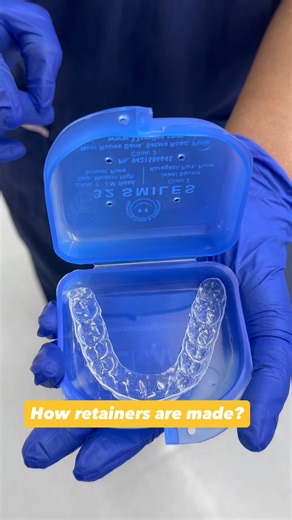 How Retainers Are Made | Step-by-Step Process
