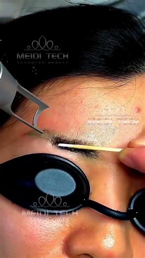 Old eyebrow tattoo removal ✨#BeautyShorts#YouTubeShorts#Shorts#Viral