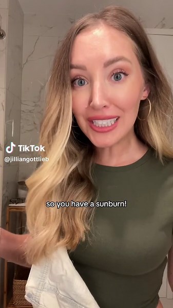 The Ultimate Sunburn Relief: Aloe Vera Skincare Tips