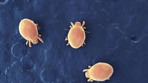 3d Rendered Medical Animation Pooping Dust 库存影片视频（100% 免版税）1027702481 | Shutterstock