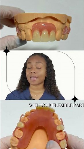 Flexible Partial Dentures for the Front Missing Teeth