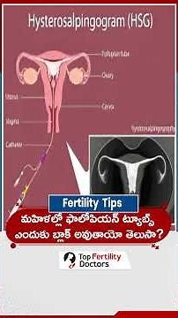 Blocked Fallopian Tubes causes and Symptoms #femaleinfertility #fallopiantubeblockage #ytshorts