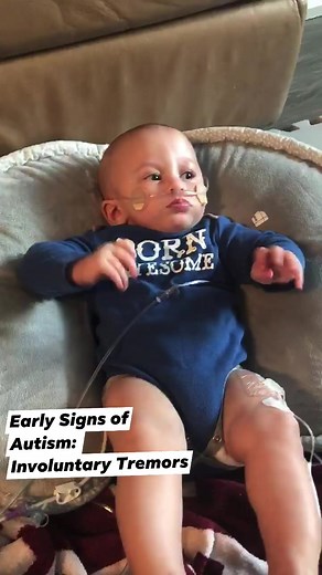 43K views · 2.3K reactions | Early Signs of Autism: Involuntary Tremors. Haven is one year old here in January 2020. We were told this is common for Preemies to have hand tremors their neurology hasn’t caught up yet. But later we realized it was one of Haven’s first sign in hand movements from his Autism.  | Baby Haven Greyson's Angels | Facebook