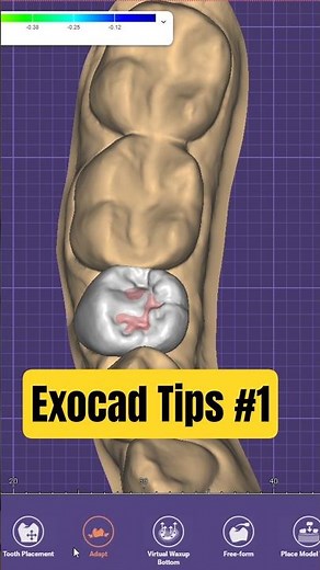 Exocad Tips #1 #dentist #dentalcaddesign #exocad #tips #dentist #dentallab