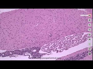 Accu-Scope Excelis AU-600-HD Microscopy Camera
