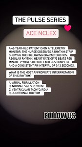 10K views · 76 reactions | The Pulse Series! ECG Daily Quiz! #nurseexam#nclex #nclexstudying #nclexprep #nurselife #nursingreview #nursingquiz #nursing #fbreels232173 | ACE NCLEX | Facebook