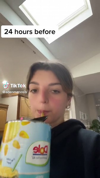 Pineapple juice in fact did not work I got a dry socket #fail #blowthisup #drysocket #wisdomteethremoval #transition #foryoupage #foryou #fyp