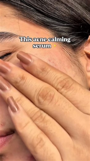 Organic Traveller | Skincare on Instagram: "For our acne girlies🤍💚 Don’t shy away, just use the right products🫶🏻 #skincare #acnehack #trending #viral #fyp"