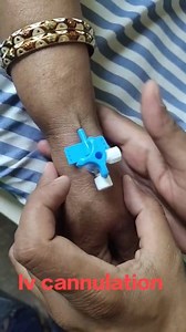 18K views · 228 reactions | Iv cannulation technique  #medical #practice #doctor #hospitalstaff #Hospital #knowledge #Youtube #medicalstudent | Dr.mhmedical | Facebook