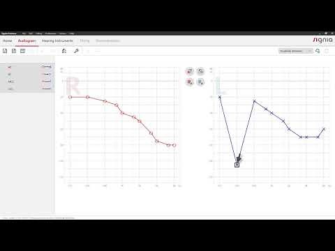 Enter an audiogram in Connexx 9 | Signia Hearing Aids