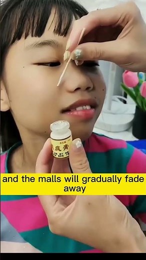 The most amazing mole removal cream! Remove freckles and moles without leaving scars