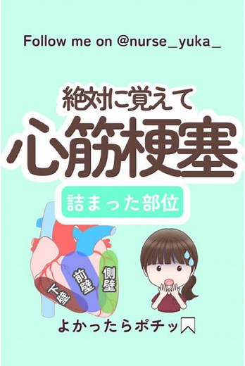 心筋梗塞と12誘導心電図の理解
