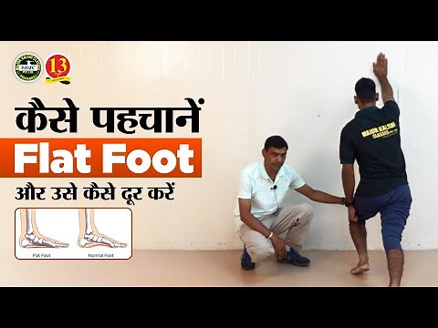 What is Flat Foot? How to check Flat Foot? How to treat Flat foot at home for medical in defence?