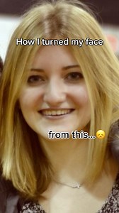 227K views · 828 reactions | How I transformed my chubby cheeks My face fitness system helped me achieve a sculpted face with defined cheekbones once I learned certain tips, which I’ll be sharing in my webinar #chubbycheeks #facefitness #faceyoga #glowup #facemassage Disclaimer: not a medical advice. For education purpose only. Consult with your physician if you have a medical condition. | Valeriia Veksler | Facebook