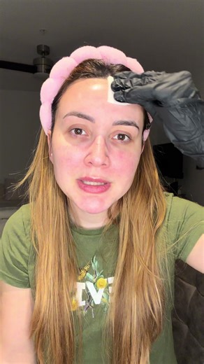 Peeling em Casa: Experimente o Peeling Jessner