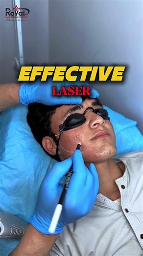 Royal Laser Treatment Center on TikTok