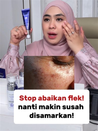 Formula baru untuk perlindungan kulit flek! Ozzaskin Sunscreen Anti Dark Spot SPF 50 PA bantu lindungi kulit dari sinar UV dan bantu wajah tampak lebih cerah merata😍 Lindungi kulitmu sekarang juga! #SS50 #ozzaskin06 #darkspot #ozzaskinbyokisetianadewi #ozzaskin